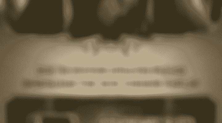 bg-2